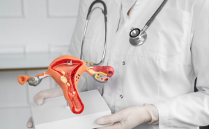 Explainer: What you need to know about ovarian cysts