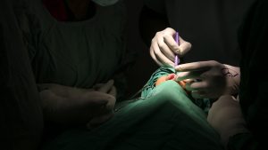 Healing Beyond the Scar: Free Surgeries Bring New Hope to Cleft Patients at JOOTRH