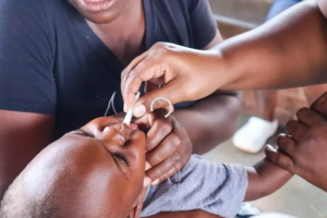 Kenya reports sharp drop in cholera cases, as numbers rise elsewhere