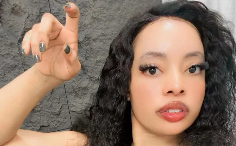 Gloria Ntazola Joins Risper Faith and Amira in Openly Sharing Cosmetic Transformations