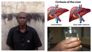 How tasting ‘kamnyweso’ left man fighting for life